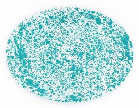 Splatterware Turquoise 18" Oval Serving Platter