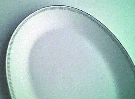 R962 11" Oval Serving Platter